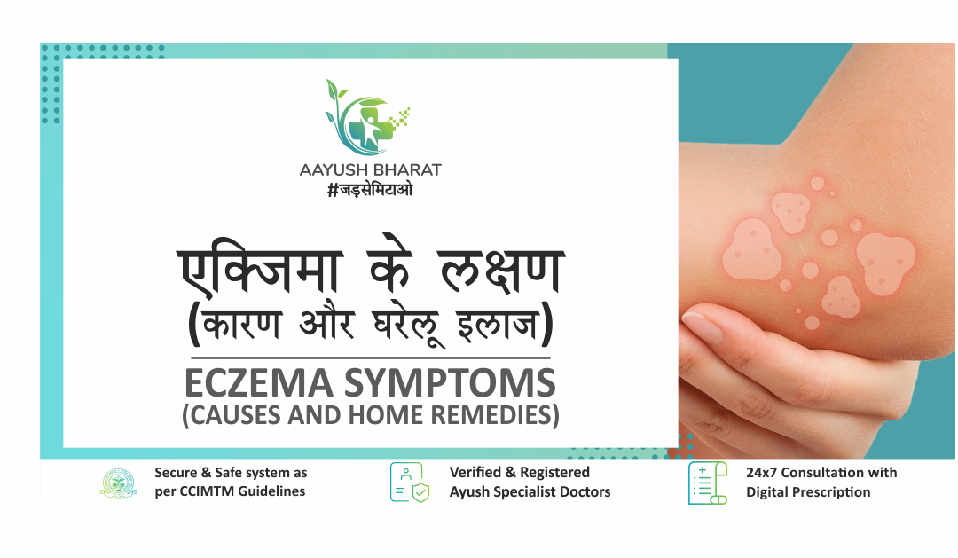 एक्जिमा के लक्षण, कारण और घरेलू इलाज