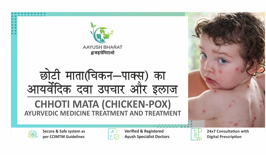 छोटी माता (चिकन-पाक्स) का आयर्वेदिक दवा उपचार और इलाज