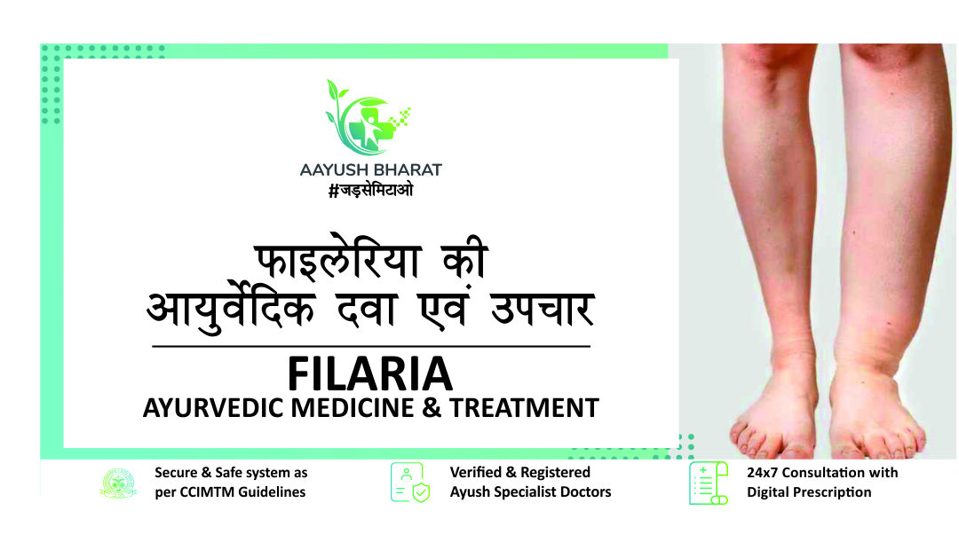 फाइलेरिया की आयुर्वेदिक दवा एवं उपचार